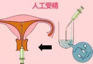 20岁做人流