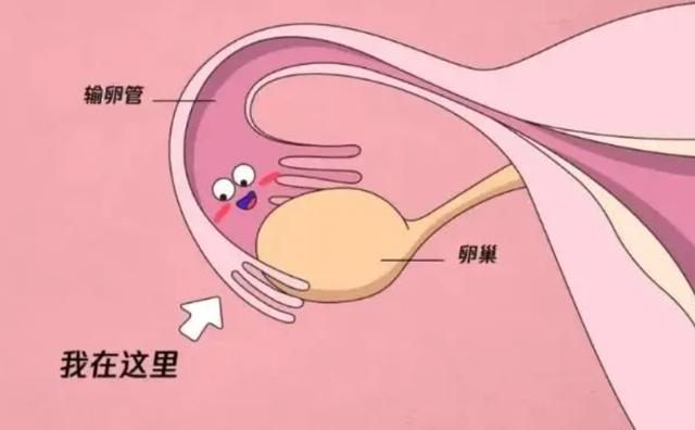 人流手术