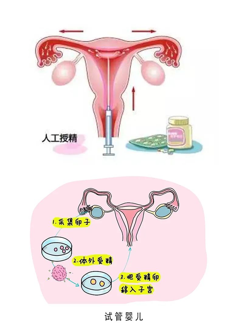 产妇顺产分娩过程外国