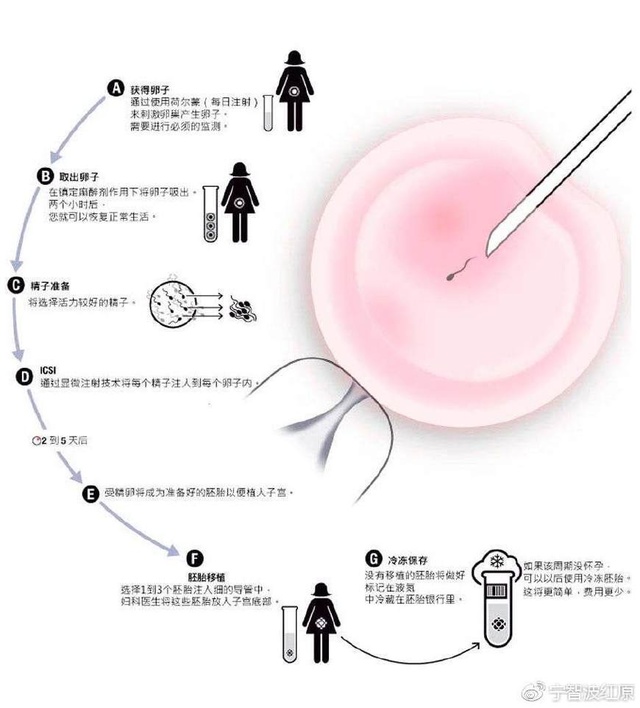 快速受孕