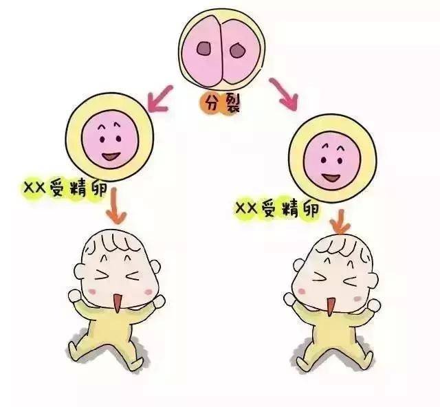 胎儿双顶径
