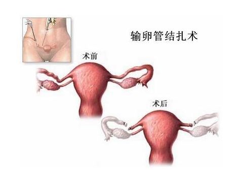 10岁儿童