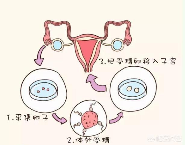 昆明试管婴儿
